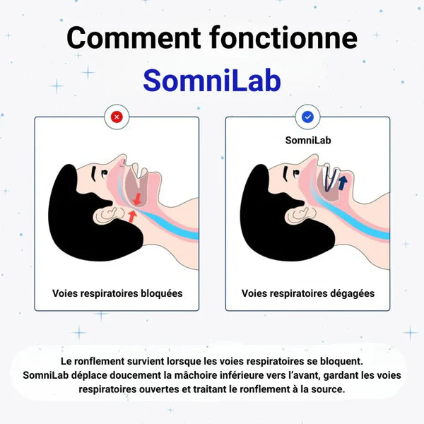 SanoRespire - Embout buccal anti-ronflement