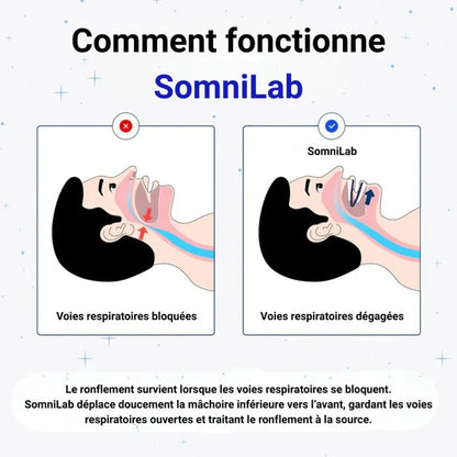 SanoRespire - Embout buccal anti-ronflement